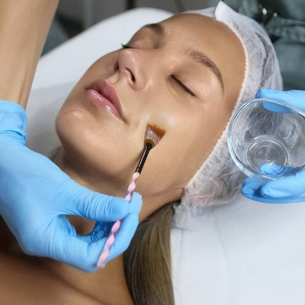 Medical Grade Chemical Peel
